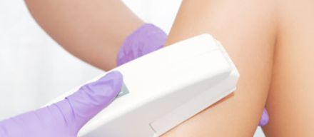 Hair Removal in Plymouth, South Devon
