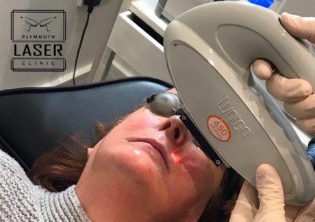 Vascular Removal