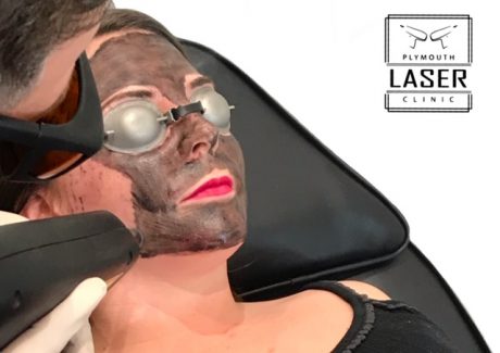 Carbon Skin Rejuvenation